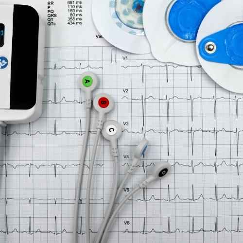 Examen Holter de Presión Arterial con orden médica: monitoreo 24 horas para diagnosticar hipertensión. Sigue tu orden de exámenes y cuida tu salud cardiovascular