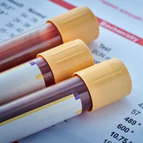 Examen de grupo sanguíneo con orden médica: conoce tu tipo y Rh para transfusiones seguras y embarazos. Solicita tu orden de exámenes.